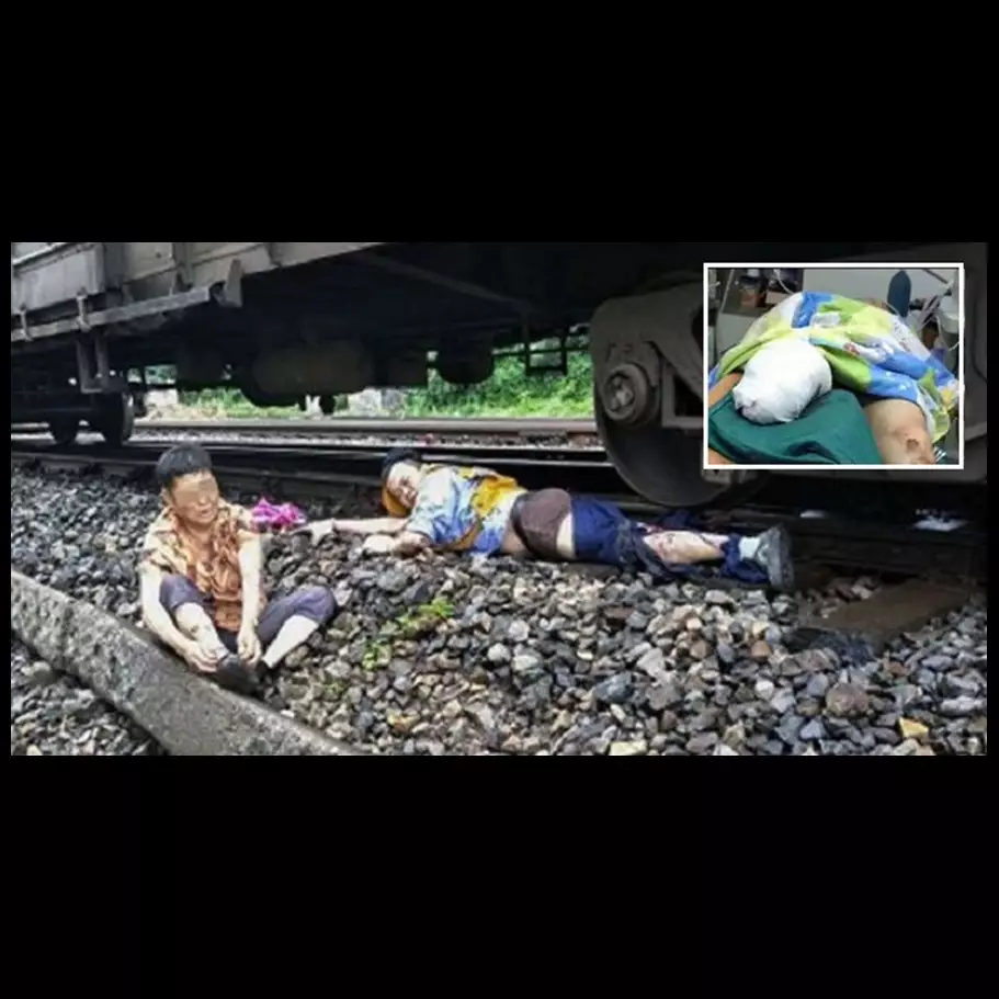 Masinis ini rela kehilangan kaki demi selamatkan wanita tua