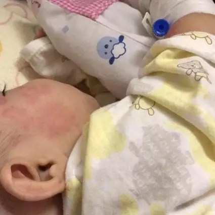 Kisah bayi salah diagnosis ini bikin para ibu harus waspada