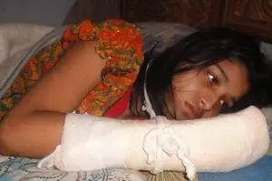 Suami ini potong jari istri hanya karena kuliah tak izin, kok tega ya?