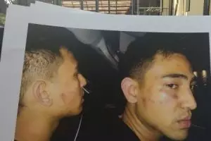 Axel Matthew babak belur, Jeremy Thomas lapor Propam