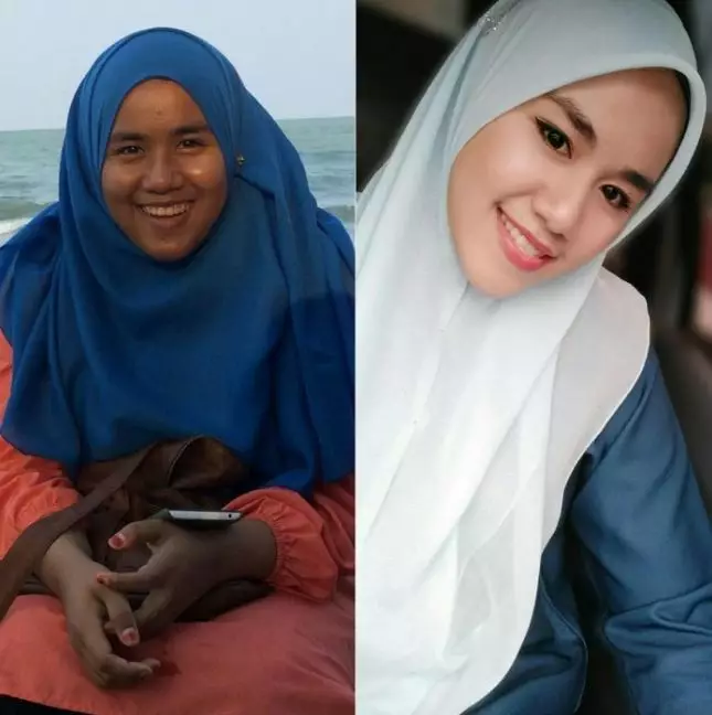 Dulu diejek badak, transformasi gadis ini bikin melongo