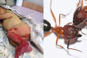 Tragis, bayi usia 3 hari ini dibuang ke hutan hingga dimakan semut