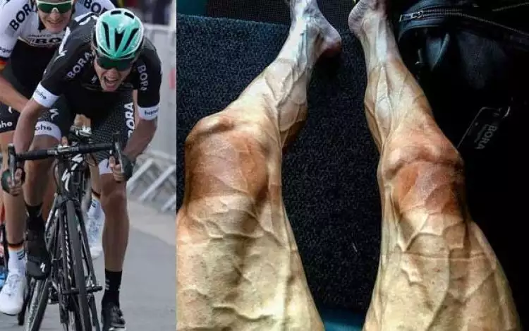 Potret ngeri kaki atlet balap sepeda dunia, ini lho penyebabnya