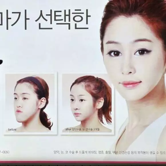 Wanita ini tusuk mata dan telinga orang yang oplas mirip wajahnya