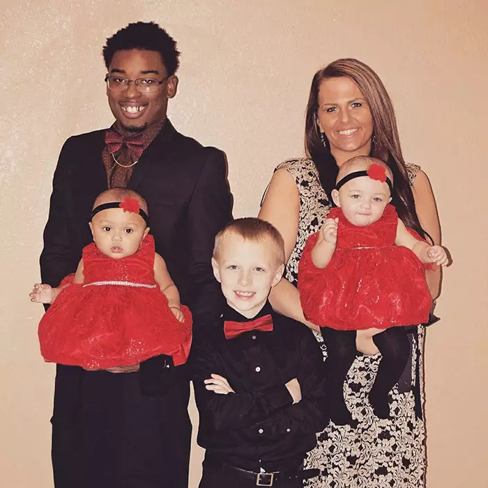 Kisah bayi kembar yang terlihat beda ras, langka tapi nyata