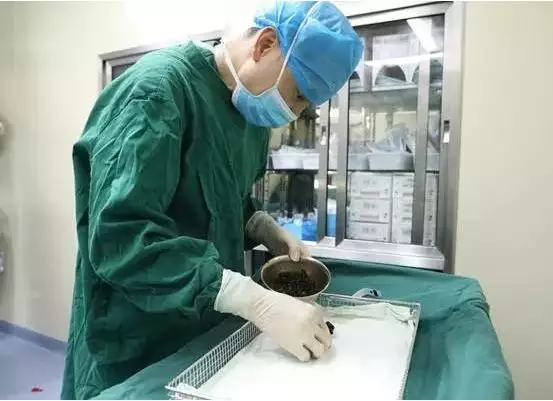 Dokter temukan 200 batu dalam tubuh wanita ini, ada yang sebesar telur