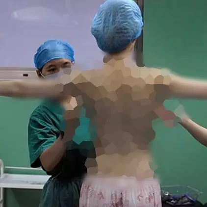 Salah dokter, hasil oplas payudara wanita ini malah jadi mengerikan