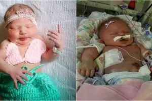 Kisah haru bayi meninggal setelah tertular penyakit melalui cium bibir