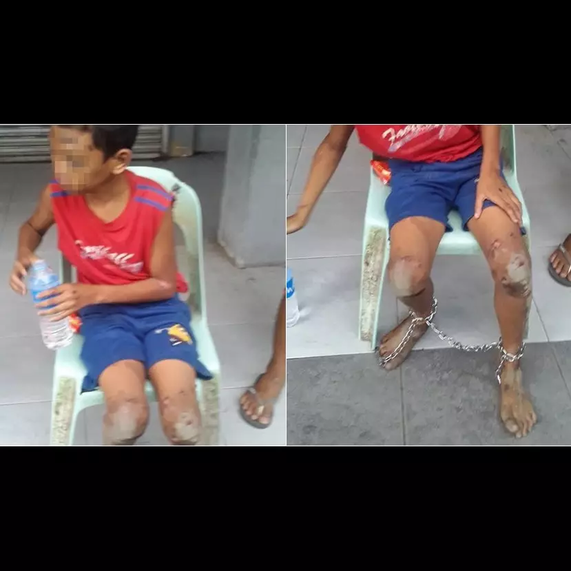 Heboh potret seorang bocah dirantai dengan luka di sekujur tubuh