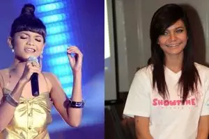 12 Foto transformasi Citra Scholastika, kini cantik bak Kylie Jenner