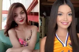 Terlihat normal dan cantik, kondisi wanita ini ternyata memprihatinkan