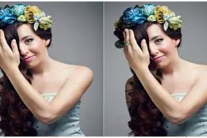 Lahir dengan cacat bawaan di wajah, gadis ini pede jadi 'model selfie'