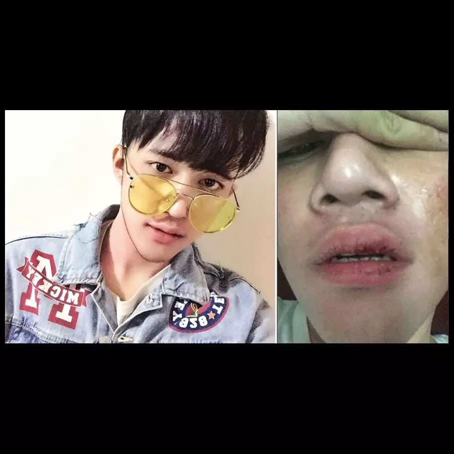 Kronologi pengeroyokan Dicky Smash hingga babak belur