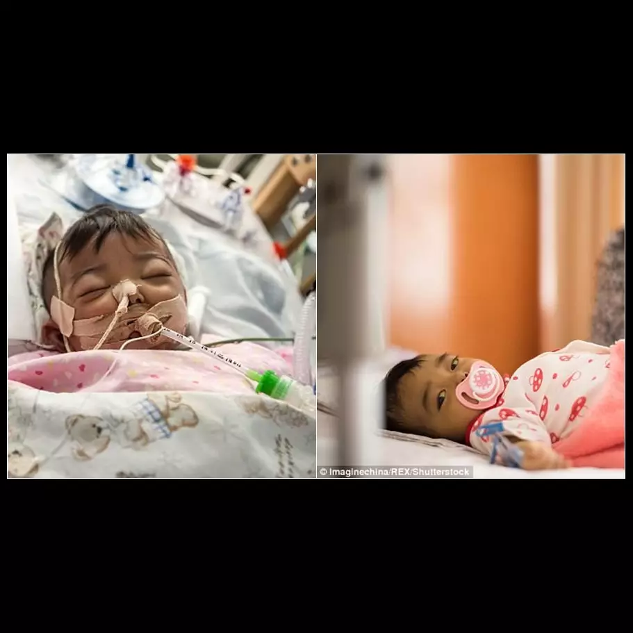 Derita penyakit langka, bayi ini ditinggal orangtuanya di rumah sakit