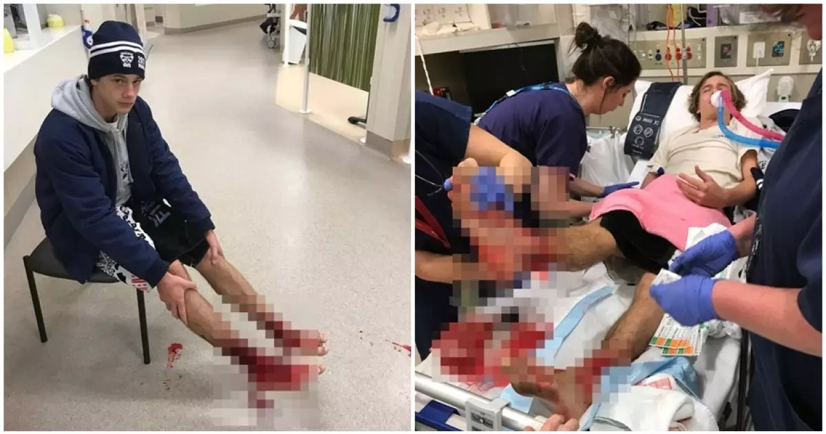 Kaki cowok ini pendarahan, ternyata 'kutu' misterius menggerogotinya