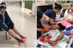 Kaki cowok ini pendarahan, ternyata 'kutu' misterius menggerogotinya