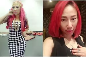 Perubahan wajah Dewi Sanca sebelum & sesudah oplas, bikin pangling