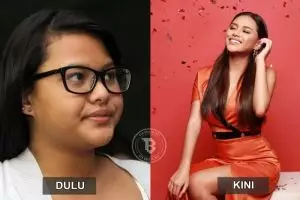 Transformasi 8 seleb sebelum dan sesudah diet, ada yang turun 75 kg