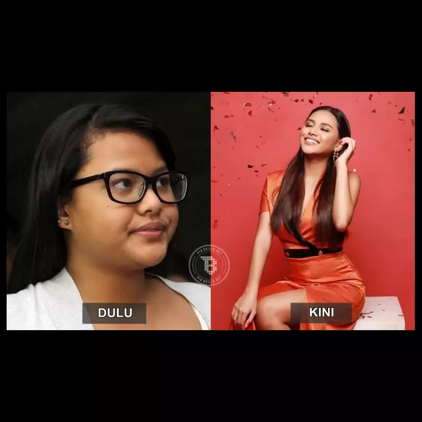 Transformasi 8 seleb sebelum dan sesudah diet, ada yang turun 75 kg