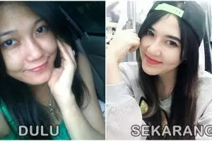 10 Foto transformasi Via Vallen sejak sebelum tenar, cantiknya natural