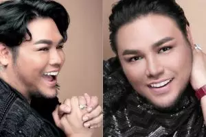 Terungkap, ini bagian tubuh Ivan Gunawan yang pernah dioperasi plastik