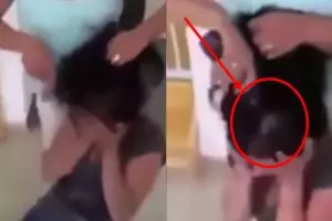 Anaknya bully penderita kanker, yang dilakukan ibu ini bikin tertegun