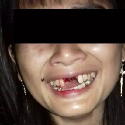 Gigi rontok ditendang suami, curhatan wanita ini bikin terenyuh