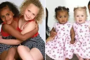 10 Pasangan beda warna kulit ini ternyata saudara kembar, tak nyangka
