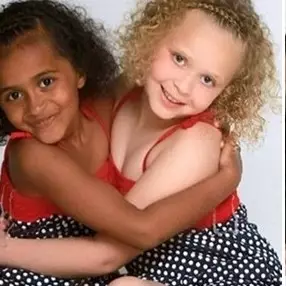 10 Pasangan beda warna kulit ini ternyata saudara kembar, tak nyangka