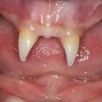 8 Kasus aneh seputar gigi, ada yang tumbuh di mata