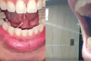 Tak semua orang bisa melakukan 10 aktivitas ini, bola mata keluar lho