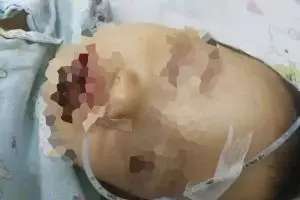 Dikira susu bubuk, bocah ini kunyah deterjen dan akibatnya mengerikan