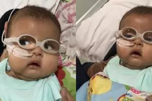 Begini kondisi terkini anak kedua Asri Welas usai operasi katarak