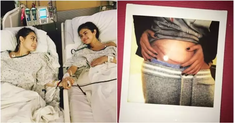 Kisah haru Selena Gomez sakit lupus, dapat donor ginjal dari sahabat