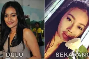 Perubahan drastis bentuk bibir 7 selebriti cantik 