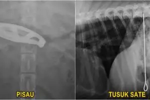 10 Benda tak terduga ini pernah ditemukan di perut hewan, kok bisa?