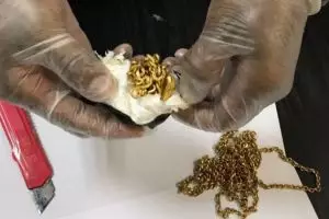 5 Benda tak biasa yang bersarang dalam dubur manusia, ada 1 kg emas