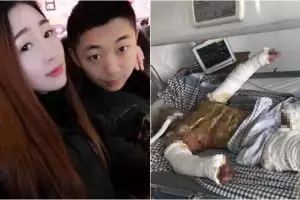 Kisah wanita setia dampingi kekasih yang alami luka bakar, bikin haru