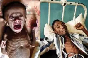 10 Virus paling mematikan, sebagian besar tak bisa disembuhkan