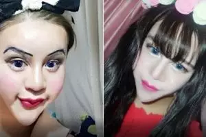 Usai operasi plastik, pria ini ngaku jadi wanita tercantik di dunia