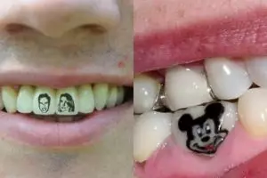 10 Kreasi tato unik di gigi, kamu berani coba?
