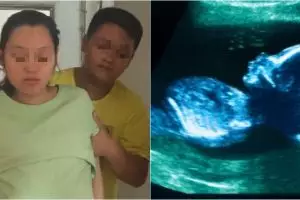 Inginkan anak laki-laki, pasangan suami istri ini nekat aborsi bayinya