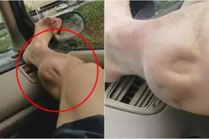 Begini cara cepat sembuhkan kram otot yang menyerang tiba-tiba