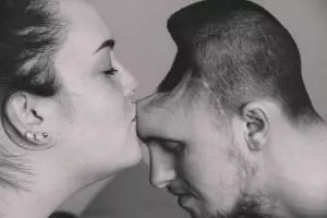 Curhatan pilu istri dampingi suami yang kehilangan kepala bagian depan