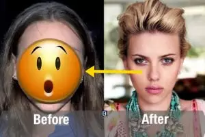 Transformasi ekstrem 10 seleb cantik Hollywood sebelum & sesudah oplas