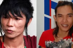 Transformasi wajah 5 seleb cowok ini drastis banget, bikin pangling 
