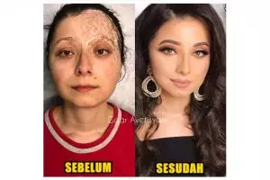 Transformasi ajaib makeup 10 cewek penderita kanker & kelainan kulit