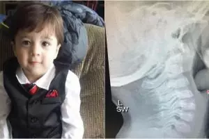 Telan anggur dan tersedak, bocah ini meninggal di hadapan ibunya