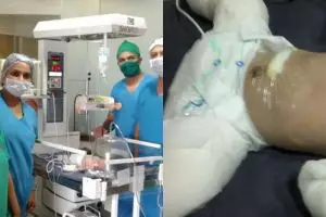 Bayi ini lahir dalam keadaan hamil, kok bisa ya?