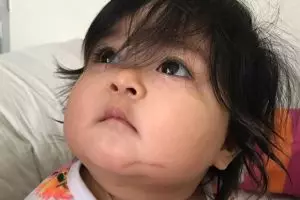 Anak artis ini alami luka bakar saat ikut belanja di toko tas branded